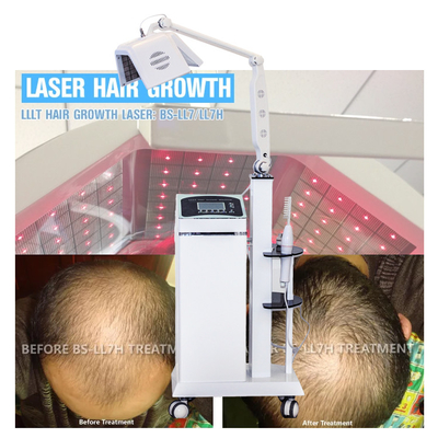 毛療法LLLTレーザー療法は実質のダイオード レーザーの毛の再生機械が付いている毛を育てます