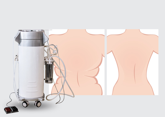 300W入力パワーの外科脂肪吸引術機械Lipo細い機械2000ml容量の貯蔵のびん
