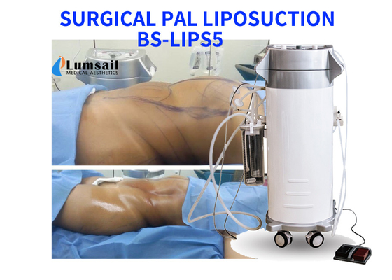 PALのCannulaセットが付いている美装置を細くする超音波外科脂肪吸引術機械