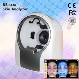 1/1.7&quot;の顔3D皮の検光子の拡大鏡機械CCDの増感装置