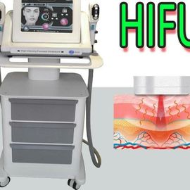 高輝度美容院の表面処置のための集中された超音波HIFUの美機械