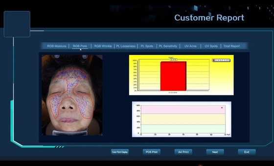 3D顔の皮の試験機の皮の気孔、しわ、点、アクネの分析装置