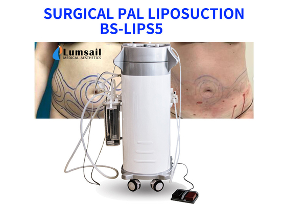 BS-LIPS5 300W力は首の胸およびChinのための脂肪吸引術装置を助けました