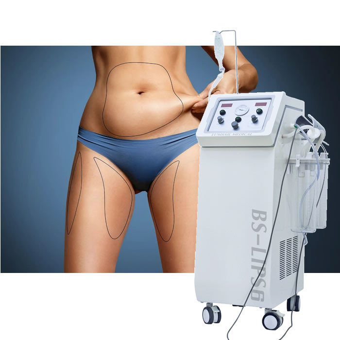 PAL脂肪吸入 プラスティック外科クリニックのための脂肪減量装置